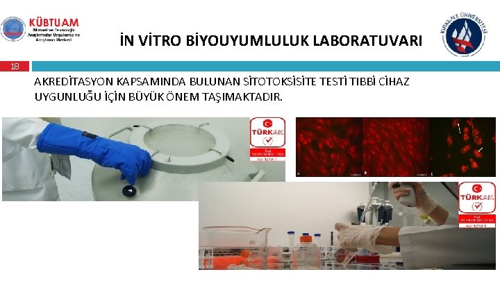 İN VİTRO BİYOUYUMLULUK LABORATUVARI 18 AKREDİTASYON KAPSAMINDA BULUNAN SİTOTOKSİSİTE TESTİ TIBBİ CİHAZ UYGUNLUĞU İÇİN