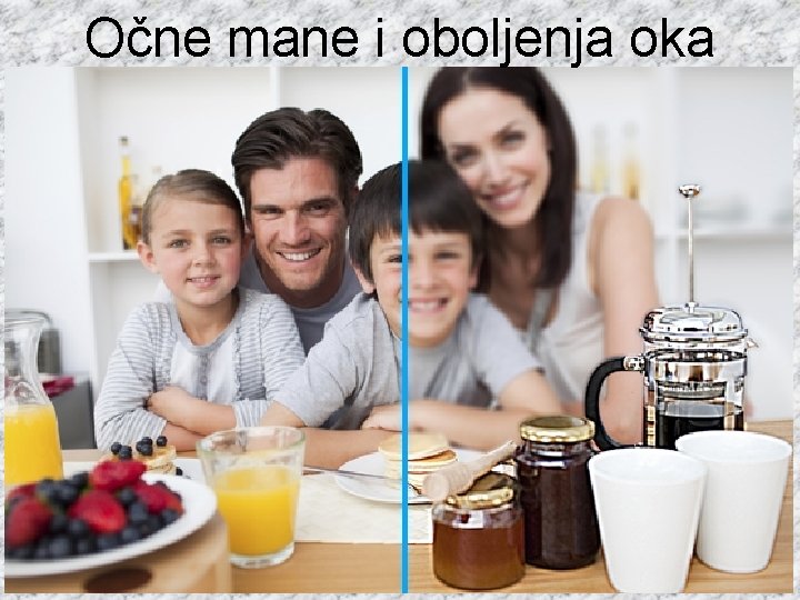 Očne mane i oboljenja oka 