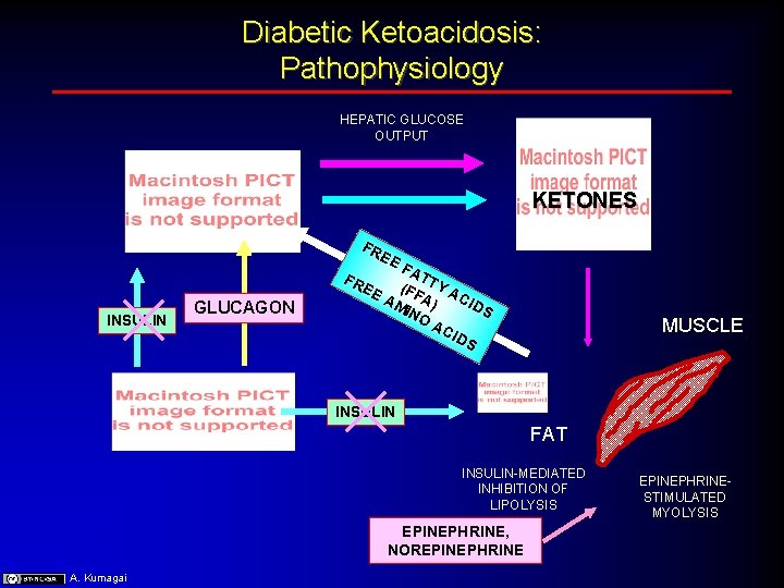 Diabetic Ketoacidosis: Pathophysiology HEPATIC GLUCOSE OUTPUT KETONES FR EE INSULIN GLUCAGON FR EE FA