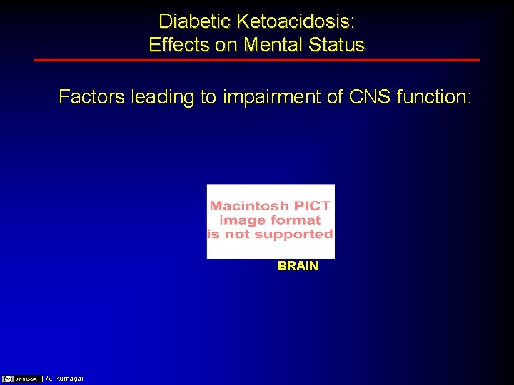 Diabetic Ketoacidosis: Effects on Mental Status Factors leading to impairment of CNS function: BRAIN