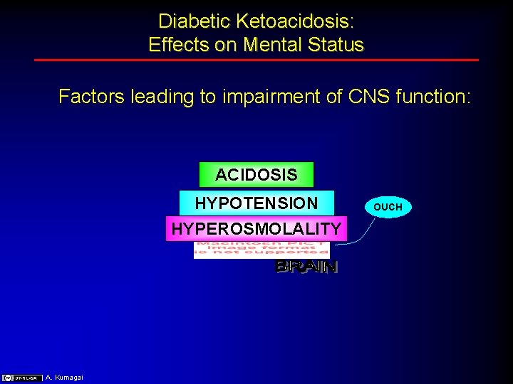 Diabetic Ketoacidosis: Effects on Mental Status Factors leading to impairment of CNS function: ACIDOSIS