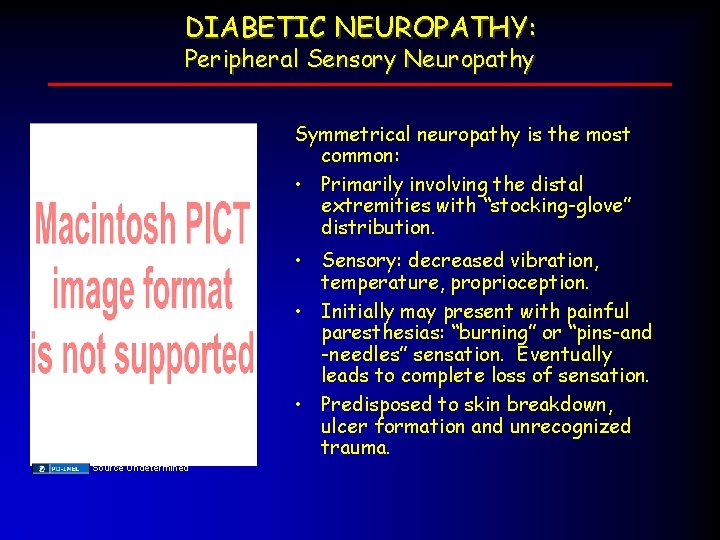 DIABETIC NEUROPATHY: Peripheral Sensory Neuropathy Symmetrical neuropathy is the most common: • Primarily involving