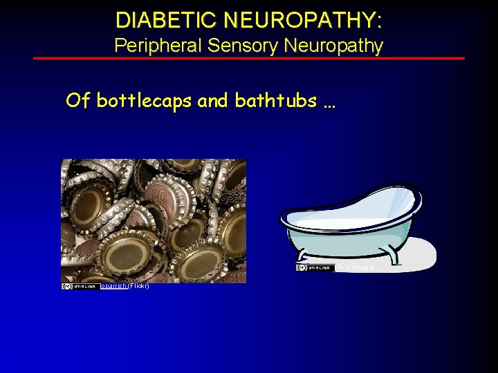 DIABETIC NEUROPATHY: Peripheral Sensory Neuropathy Of bottlecaps and bathtubs … A. Kumagai oparrish (Flickr)