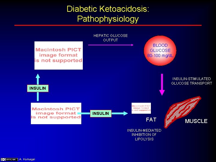 Diabetic Ketoacidosis: Pathophysiology HEPATIC GLUCOSE OUTPUT BLOOD GLUCOSE 80 -100 mg/d. L INSULIN-STIMULATED GLUCOSE