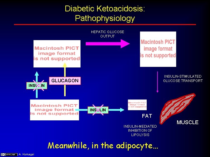 Diabetic Ketoacidosis: Pathophysiology HEPATIC GLUCOSE OUTPUT INSULIN-STIMULATED GLUCOSE TRANSPORT GLUCAGON INSULIN FAT INSULIN-MEDIATED INHIBITION