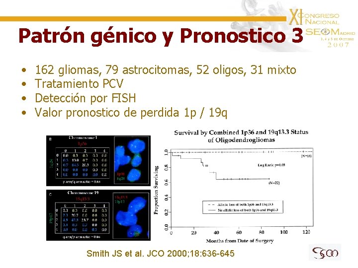 Patrón génico y Pronostico 3 • • 162 gliomas, 79 astrocitomas, 52 oligos, 31