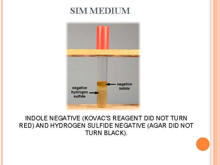 SIM MEDIUM INDOLE NEGATIVE (KOVAC'S REAGENT DID NOT TURN RED) AND HYDROGEN SULFIDE NEGATIVE