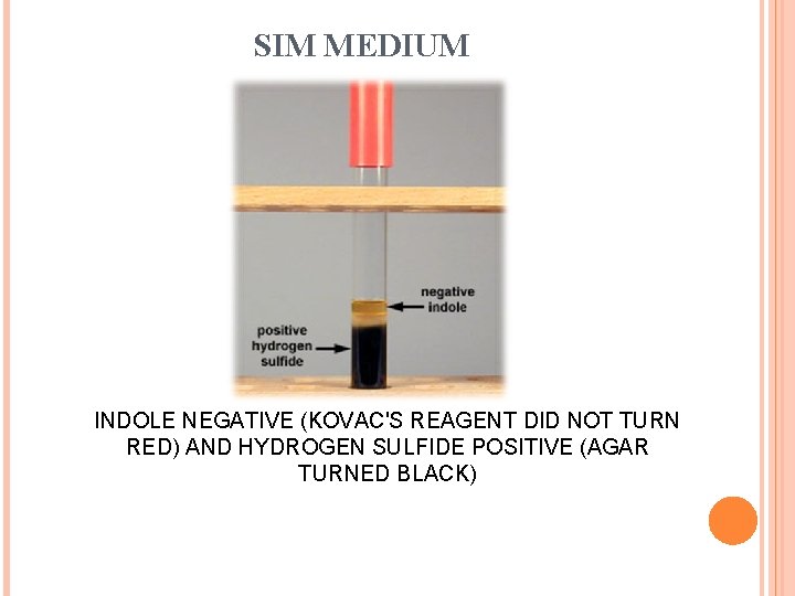 SIM MEDIUM INDOLE NEGATIVE (KOVAC'S REAGENT DID NOT TURN RED) AND HYDROGEN SULFIDE POSITIVE