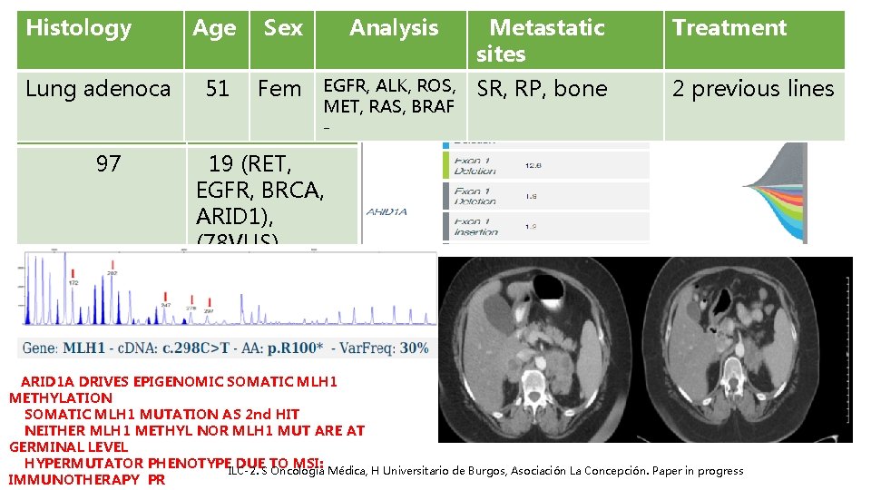 Histology Lung adenoca Genomic alts 97 Age Sex Analysis Metastatic sites Treatment 51 Fem