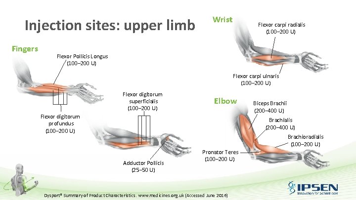 Injection sites: upper limb Fingers Wrist Flexor carpi radialis (100– 200 U) Flexor Pollicis