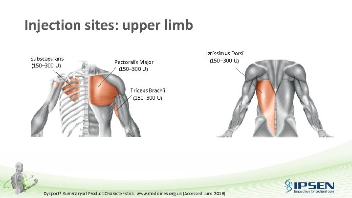 Injection sites: upper limb Subscapularis (150– 300 U) Pectoralis Major (150– 300 U) Latissimus