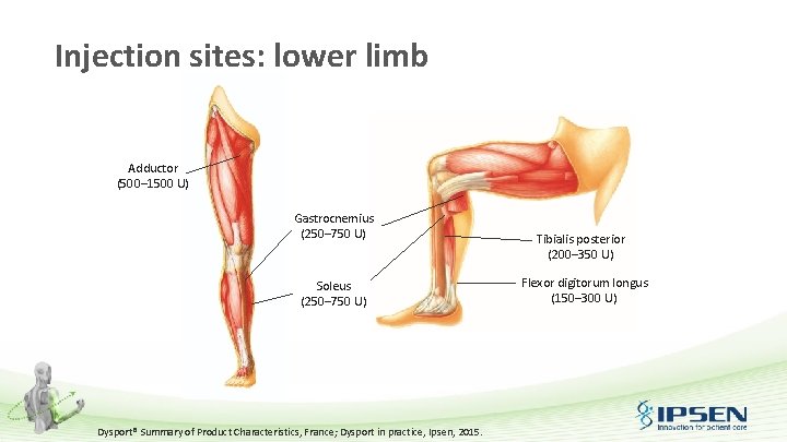 Injection sites: lower limb Adductor (500– 1500 U) Gastrocnemius (250– 750 U) Soleus (250–