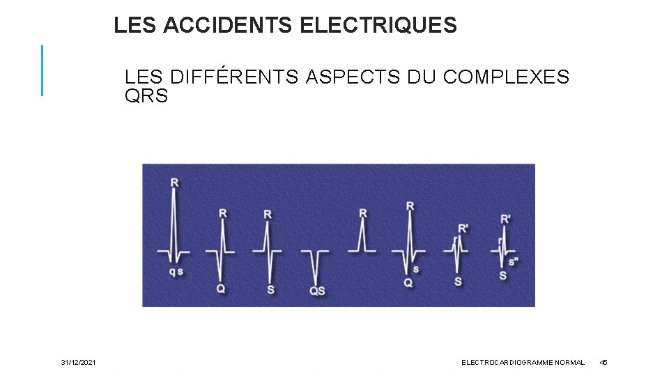LES ACCIDENTS ELECTRIQUES LES DIFFÉRENTS ASPECTS DU COMPLEXES QRS 31/12/2021 ELECTROCARDIOGRAMME NORMAL 45 