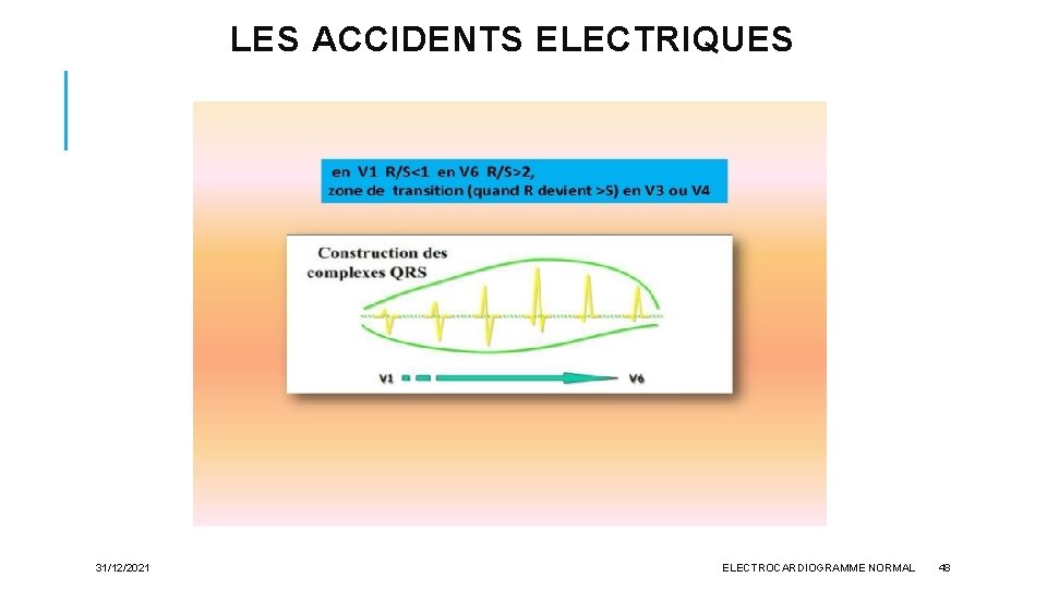 LES ACCIDENTS ELECTRIQUES 31/12/2021 ELECTROCARDIOGRAMME NORMAL 48 