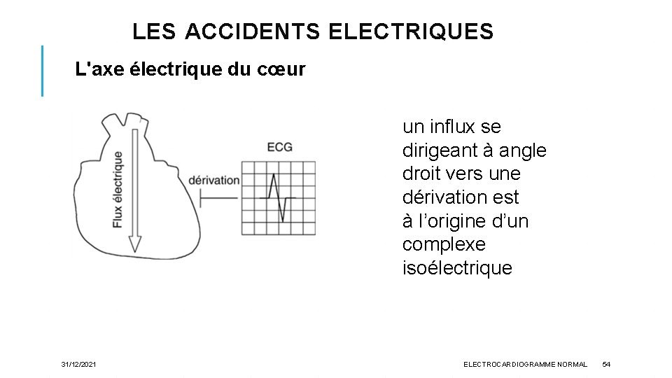 LES ACCIDENTS ELECTRIQUES L'axe électrique du cœur un influx se dirigeant à angle droit