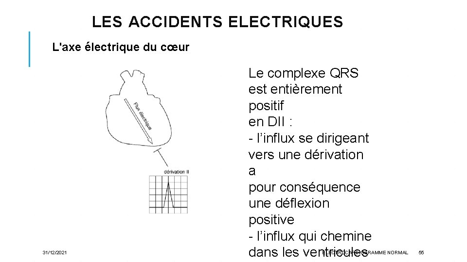 LES ACCIDENTS ELECTRIQUES L'axe électrique du cœur 31/12/2021 Le complexe QRS est entièrement positif
