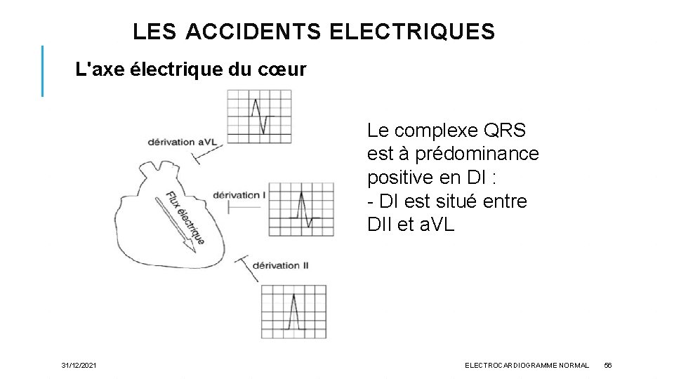 LES ACCIDENTS ELECTRIQUES L'axe électrique du cœur Le complexe QRS est à prédominance positive