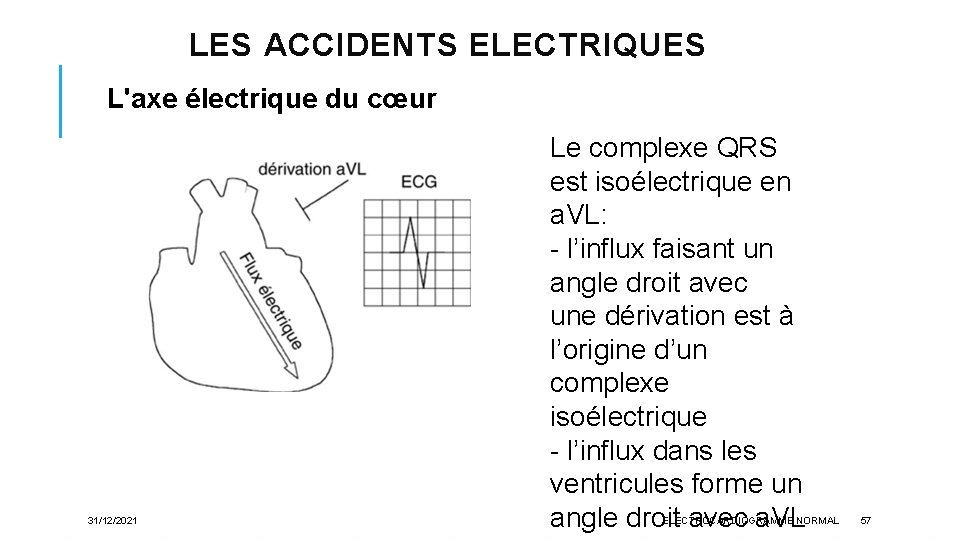 LES ACCIDENTS ELECTRIQUES L'axe électrique du cœur 31/12/2021 Le complexe QRS est isoélectrique en