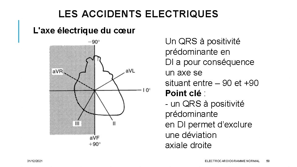 LES ACCIDENTS ELECTRIQUES L'axe électrique du cœur Un QRS à positivité prédominante en DI