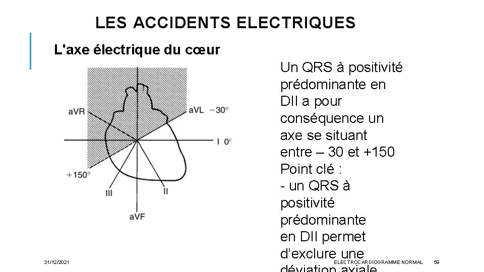 LES ACCIDENTS ELECTRIQUES L'axe électrique du cœur 31/12/2021 Un QRS à positivité prédominante en