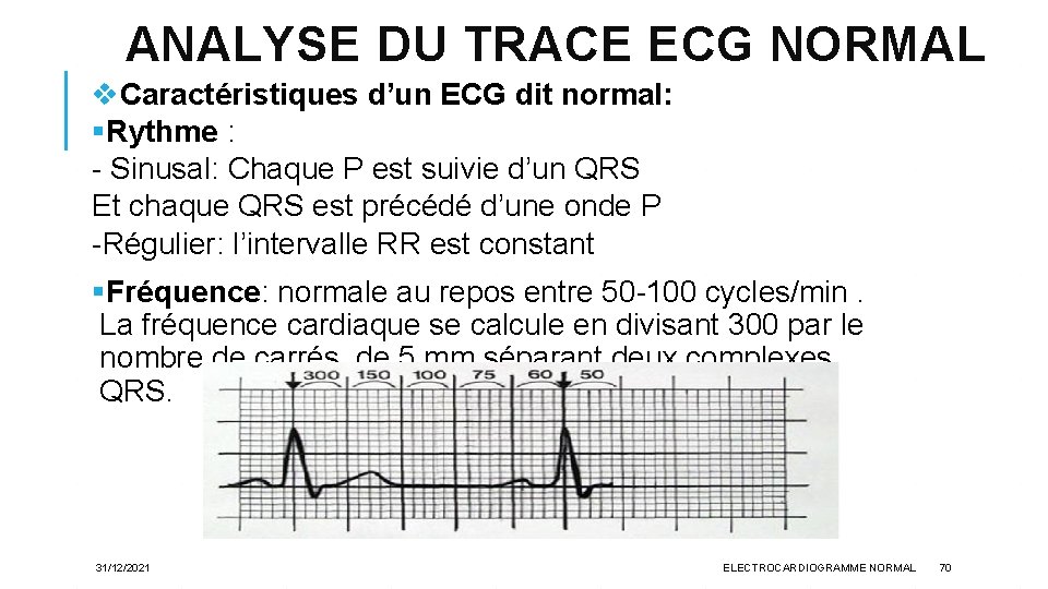 ANALYSE DU TRACE ECG NORMAL v. Caractéristiques d’un ECG dit normal: §Rythme : -