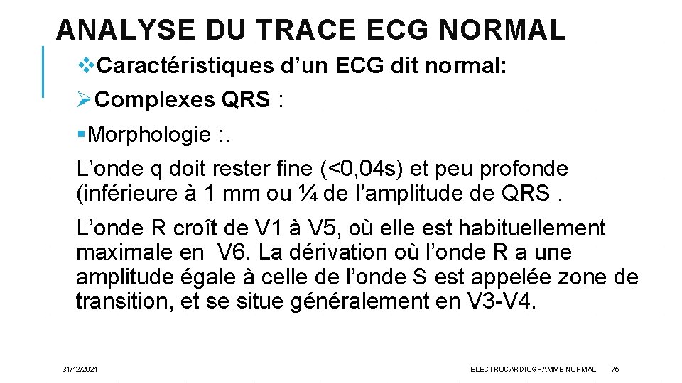 ANALYSE DU TRACE ECG NORMAL v. Caractéristiques d’un ECG dit normal: ØComplexes QRS :