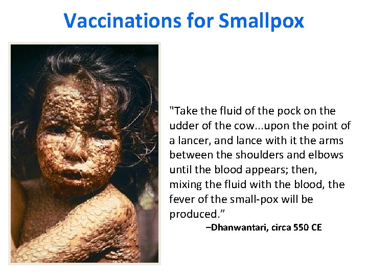 Vaccinations for Smallpox "Take the fluid of the pock on the udder of the