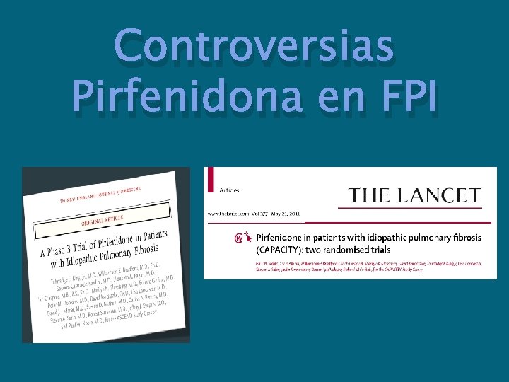 Controversias Pirfenidona en FPI 