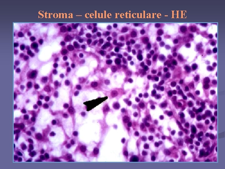 Stroma – celule reticulare - HE 