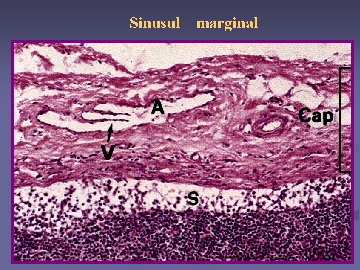Sinusul marginal 