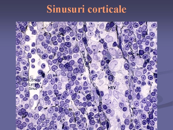 Sinusuri corticale 