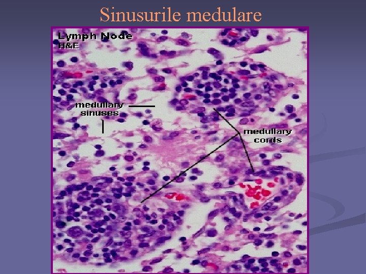 Sinusurile medulare 