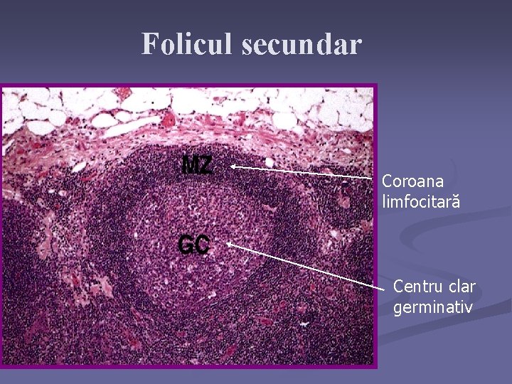 Folicul secundar Coroana limfocitară Centru clar germinativ 