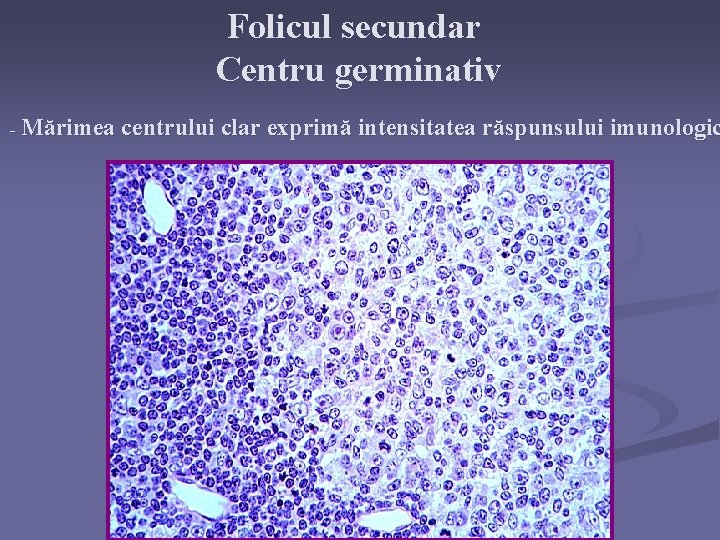 Folicul secundar Centru germinativ - Mărimea centrului clar exprimă intensitatea răspunsului imunologic 