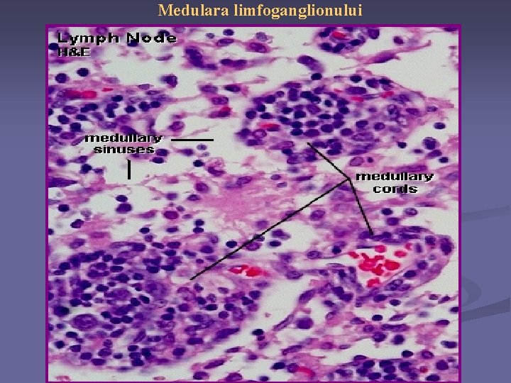 Medulara limfoganglionului 