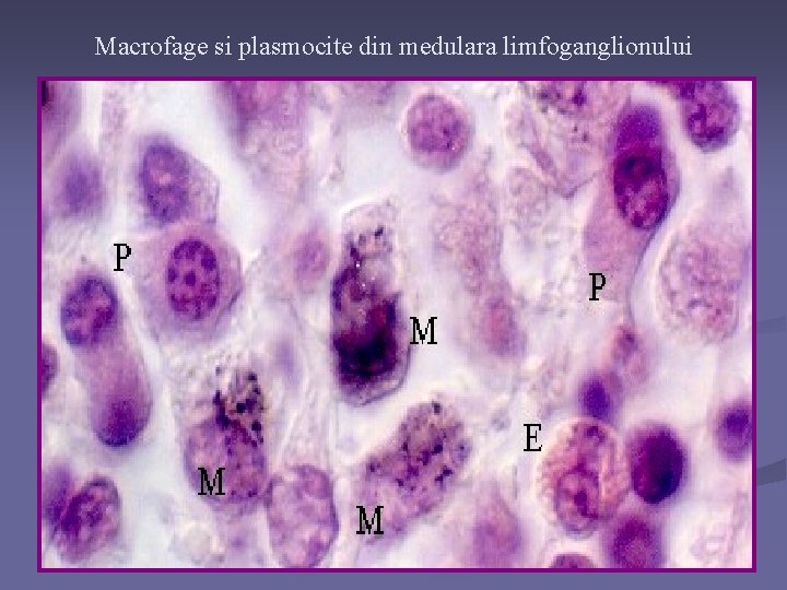 Macrofage si plasmocite din medulara limfoganglionului 