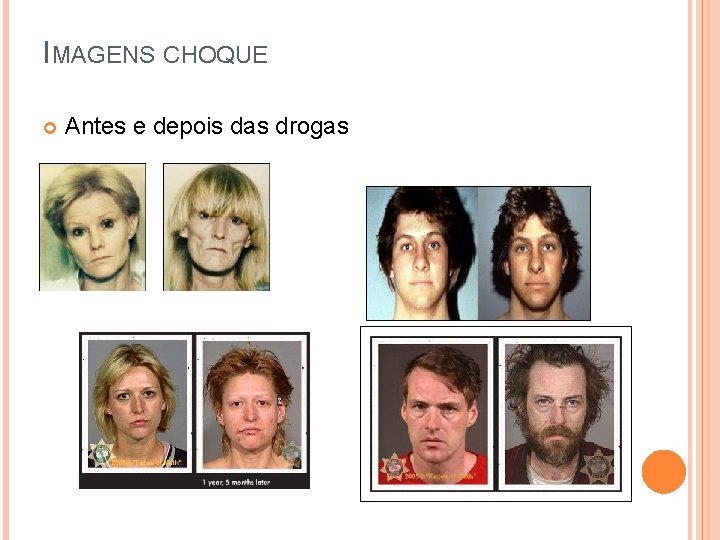IMAGENS CHOQUE Antes e depois das drogas 