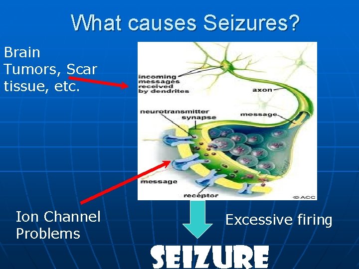 What causes Seizures? Brain Tumors, Scar tissue, etc. Ion Channel Problems Excessive firing SEIZURE What causes Seizures? Brain Tumors, Scar tissue, etc. Ion Channel Problems Excessive firing SEIZURE