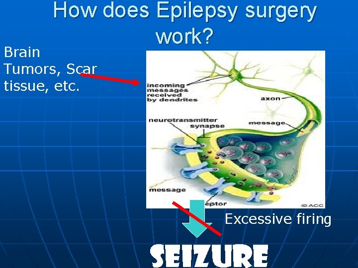 How does Epilepsy surgery work? Brain Tumors, Scar tissue, etc. Excessive firing SEIZURE How does Epilepsy surgery work? Brain Tumors, Scar tissue, etc. Excessive firing SEIZURE
