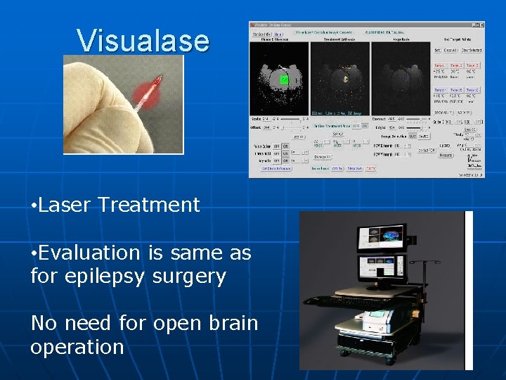 Visualase • Laser Treatment • Evaluation is same as for epilepsy surgery No need Visualase • Laser Treatment • Evaluation is same as for epilepsy surgery No need