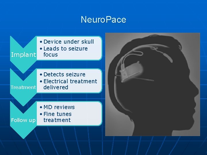 Neuro. Pace • Device under skull • Leads to seizure Implant focus • Detects Neuro. Pace • Device under skull • Leads to seizure Implant focus • Detects