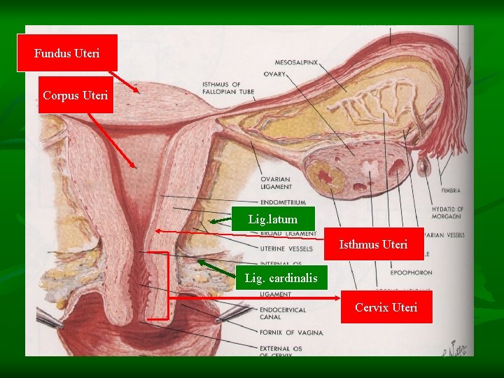 Fundus Uteri Corpus Uteri Lig. latum Isthmus Uteri Lig. cardinalis Cervix Uteri 