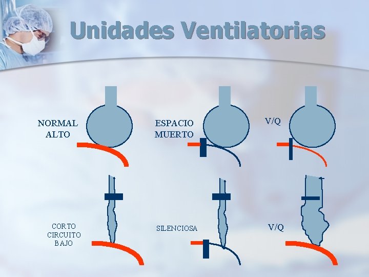 Unidades Ventilatorias NORMAL ALTO CORTO CIRCUITO BAJO ESPACIO MUERTO SILENCIOSA V/Q Unidades Ventilatorias NORMAL ALTO CORTO CIRCUITO BAJO ESPACIO MUERTO SILENCIOSA V/Q