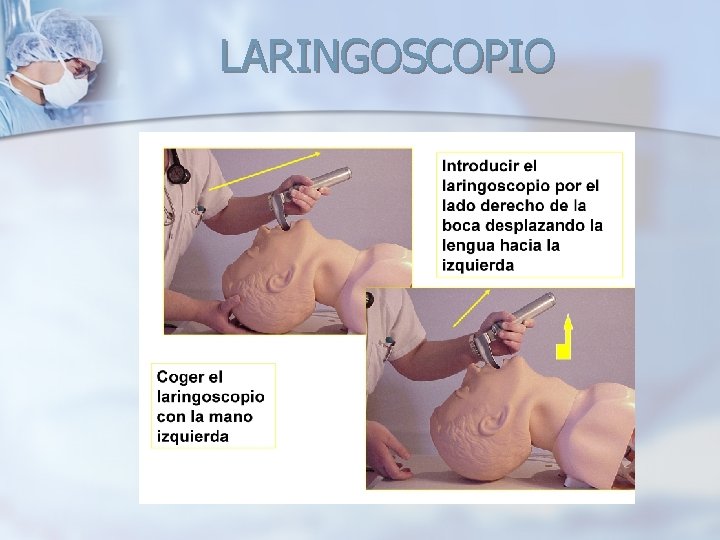 LARINGOSCOPIO LARINGOSCOPIO