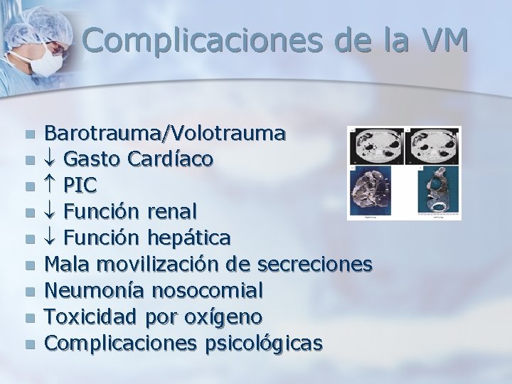 Complicaciones de la VM n n n n n Barotrauma/Volotrauma Gasto Cardíaco PIC Función Complicaciones de la VM n n n n n Barotrauma/Volotrauma Gasto Cardíaco PIC Función