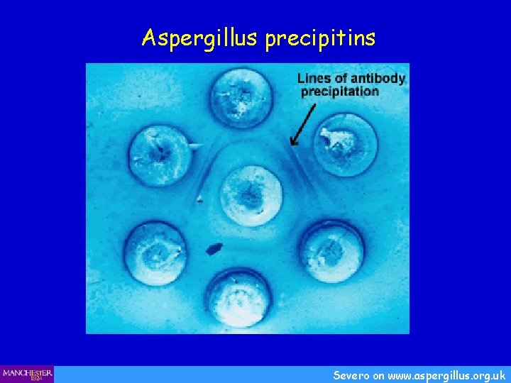 Aspergillus precipitins Severo on www. aspergillus. org. uk 