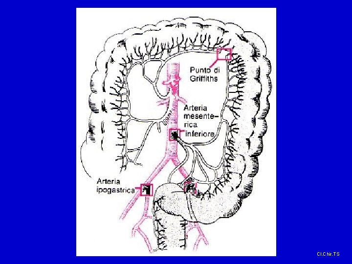 Cl. Chir. TS 
