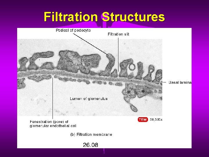 Filtration Structures 