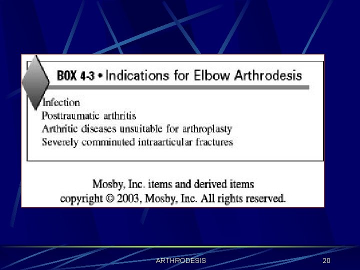 ARTHRODESIS 20 