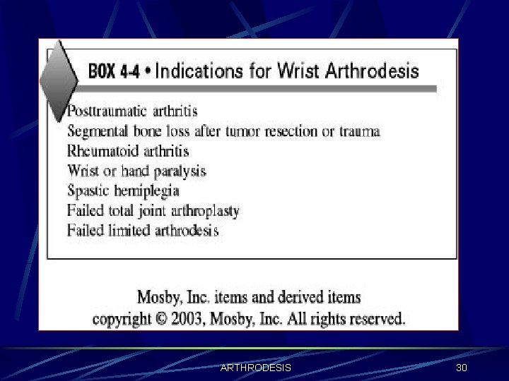 ARTHRODESIS 30 